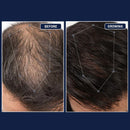 FEG™ NMN - Sérum Folículo Reverso